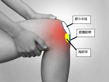 膝蓋下脂肪体炎という障害 佐渡島の総合ガイド さどポン